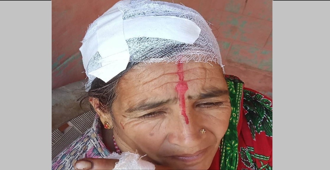 बाँदरको आक्रमणबाट महिला घाइते