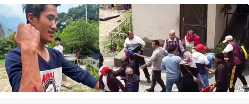 टेलिकमको कार्यालयभित्र हात हालाहाल, कसरी भयो झगडा ?